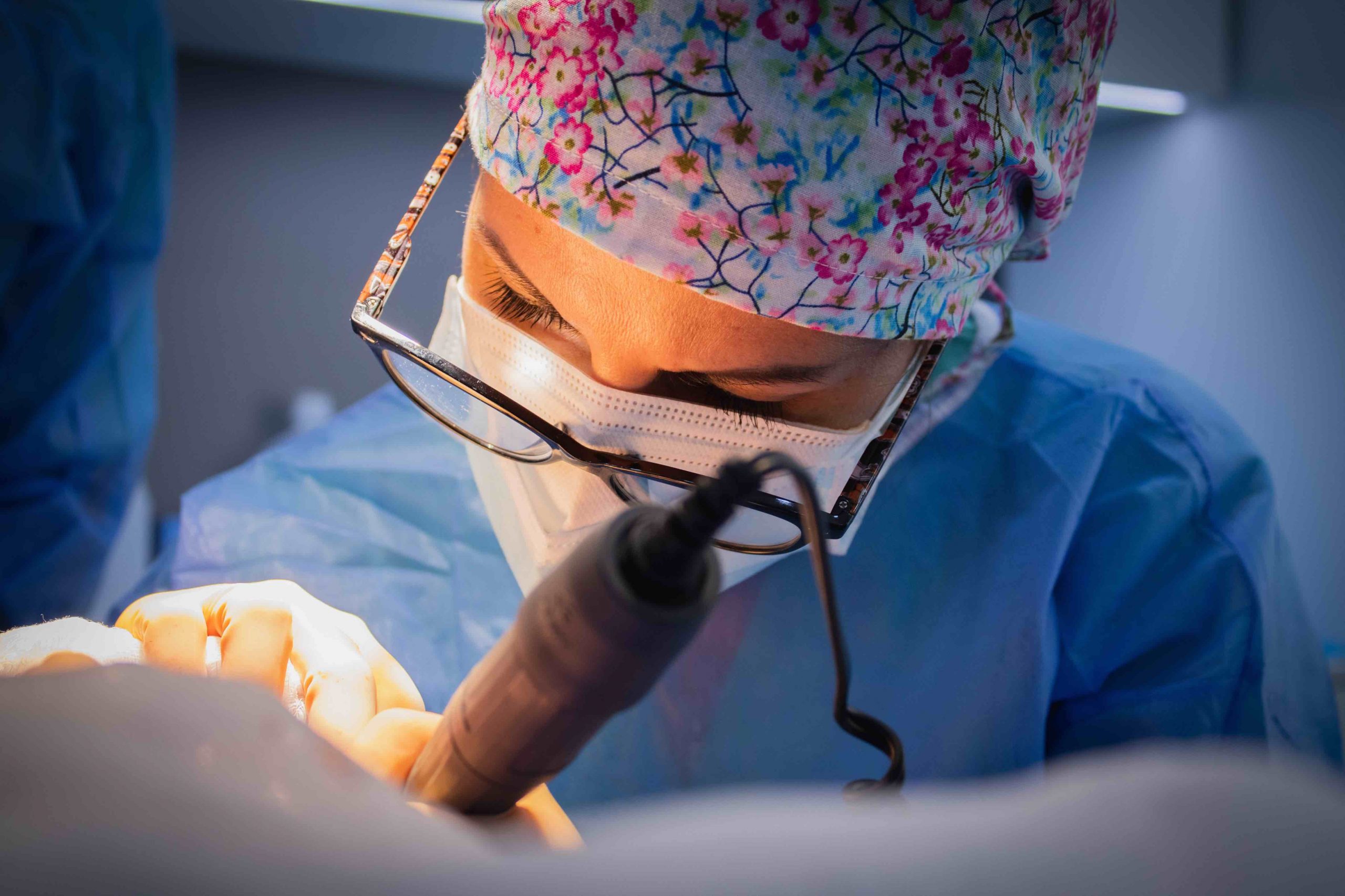 Implant capil·lar en fase d'extracció d'unitats fol·liculars
