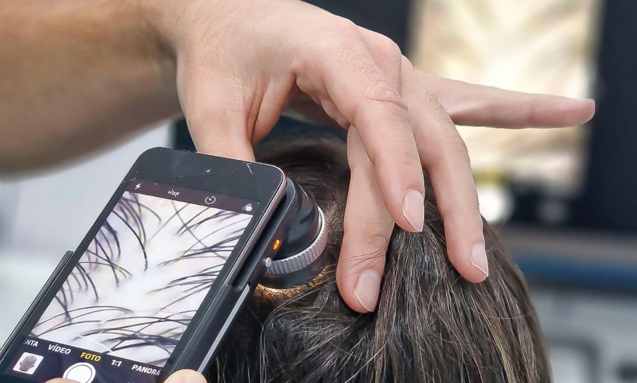 Análisis capilar del cabello de una mujer con tricoscopio