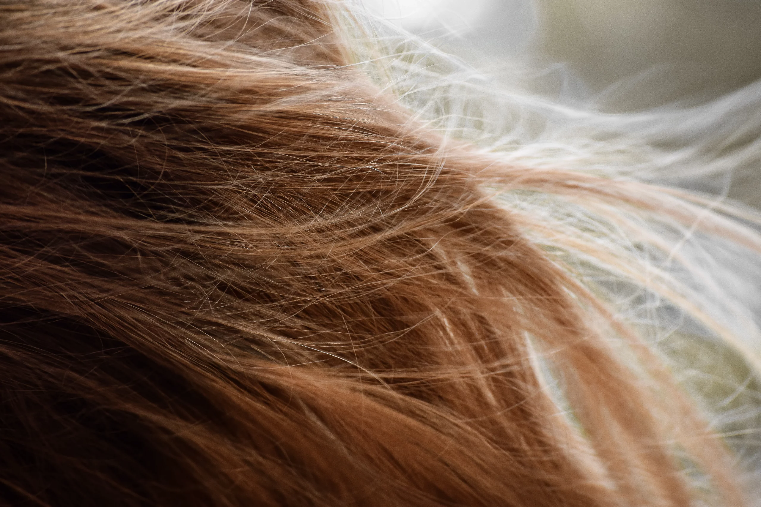 Enfermedades del cuero cabelludo más comunes: ¿Cómo detectarlas?