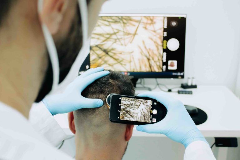 Médico explorando o cabelo de um paciente na fase desértica em um enxerto capilar